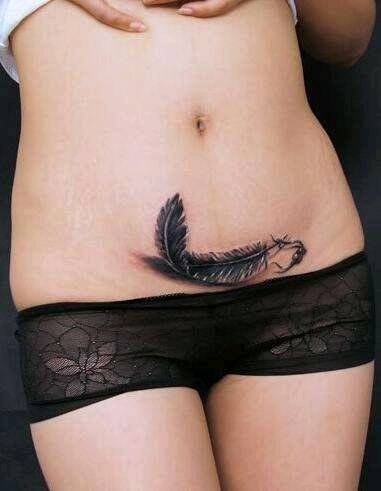 有没有宝妈疤痕增生去纹身的