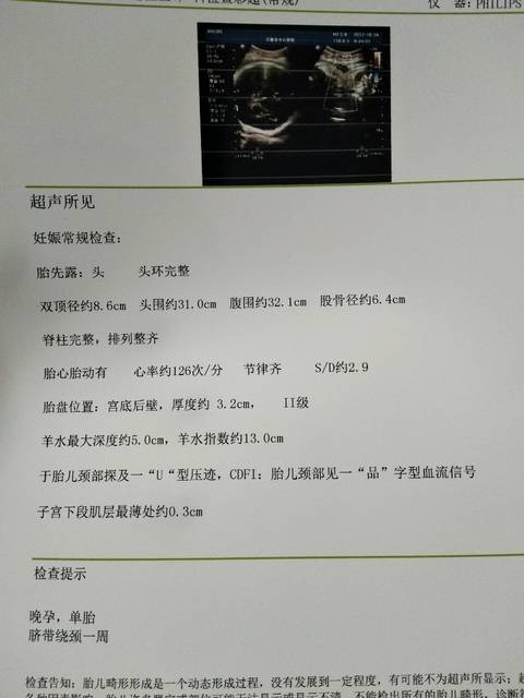 听说产后抑郁症,我可成了产前抑郁症,有懂看单子的?