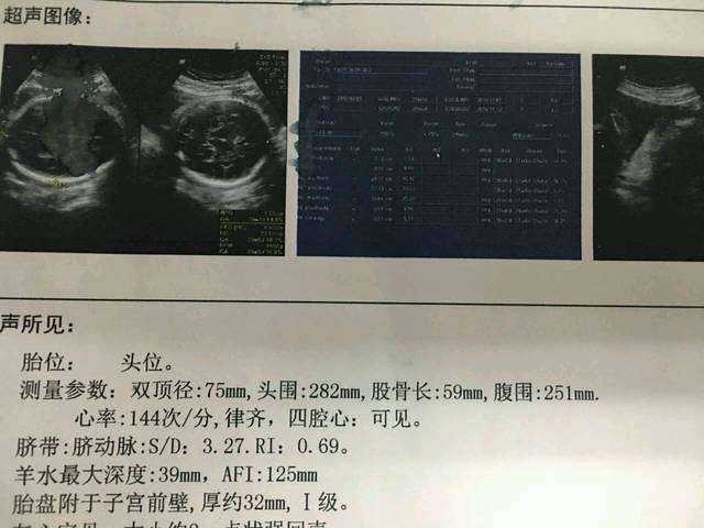 做过了孕晚期B超,宝宝正常_在上海百佳妇产医