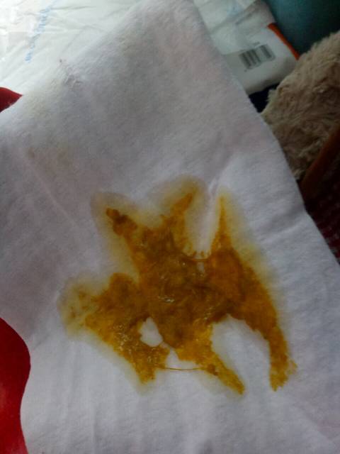 没满月的宝宝大便一直是稀的正常吗?附图_没