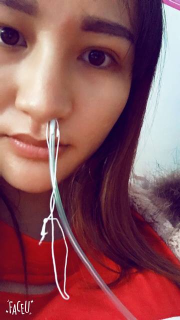 胎动少_这两天胎动少,今天来医院检查了,胎监