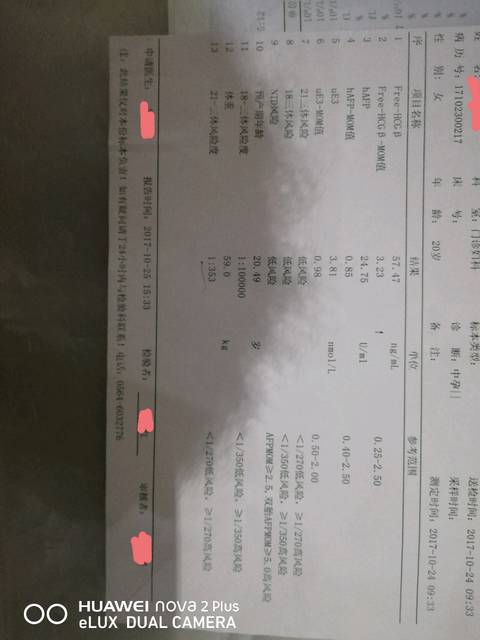 唐筛高危怎么办?好吓人?_RT: 前两天拿到报告