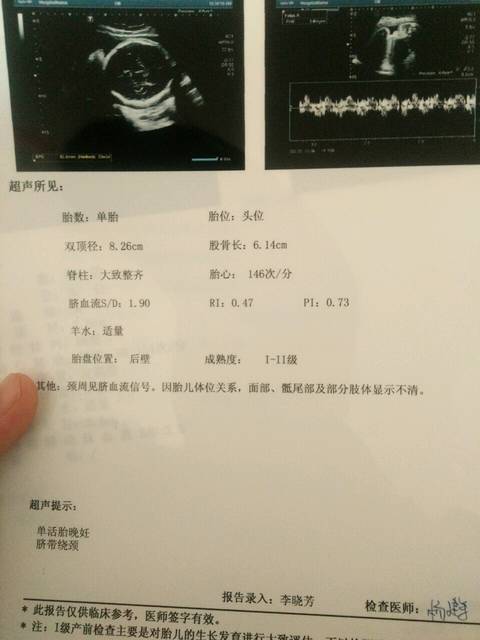 子宫收缩啥感觉?现在孕32周加5天了_胎盘成熟