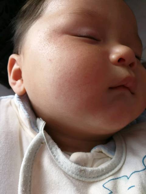 冬季宝宝脸干脸抻脸红怎么办?_宝宝最近脸红