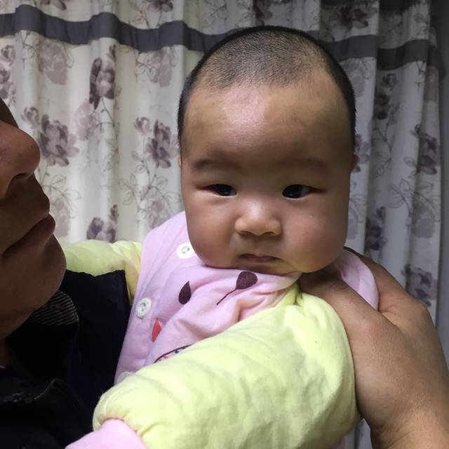 宝宝肤色不均匀怎么办,额头像有淡斑一样_宝宝