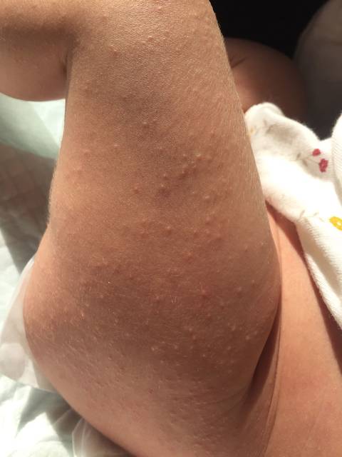 产后42天_母子产后42天,大人挂什么科检查些