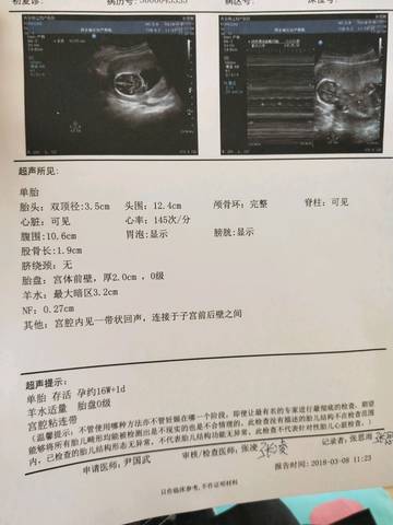 aiaa journal 模拟器_电脑显示usn journal_怎么解决usn journal