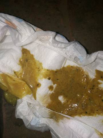 开始积食,积食下去了,就开始