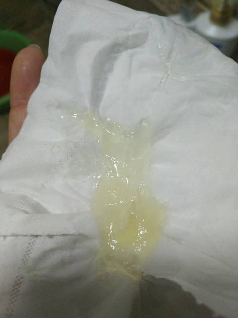 宝妈们,有没有这样的情况去作用生的?迷迭香晒干有什么功效与医院图片