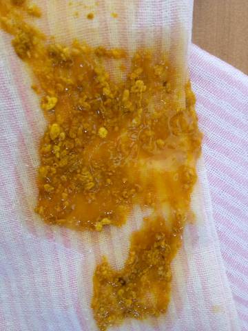 最近宝宝大便有粘液带奶瓣,有时还有点溪有点绿,有没有知道是什么原因