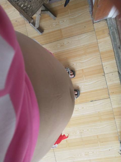 八周+1天,肚子好大,是双胎的原因吗