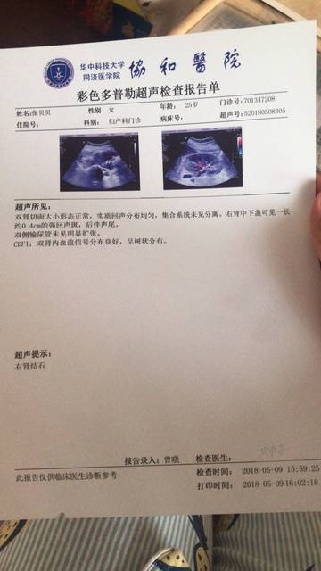 孕14周查出右侧肾结石0.4cm担心宝宝