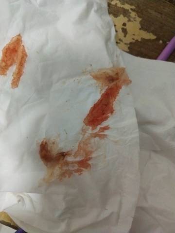 十几天没来查血说像又不像今天昨天出血了 今