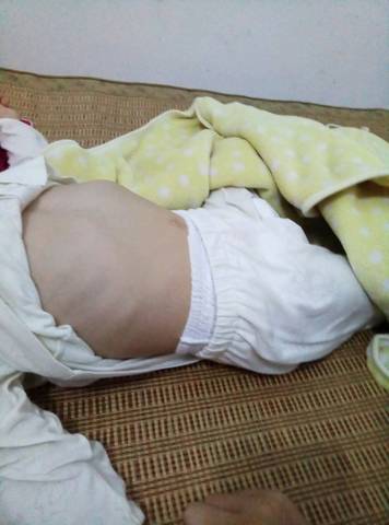 快三岁的女宝宝胸前凸起怎么回事,睡觉的时候平躺着感觉比肚子高了