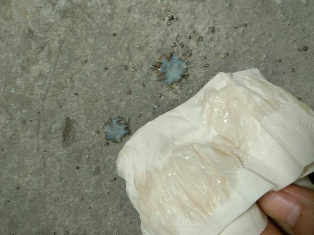20周 阴道分泌物特别多 有图慎入