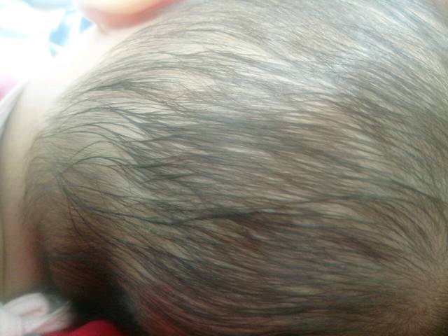 宝妈们,你家宝宝头上出汗多吗?