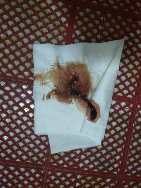 孕8周出血怎么办