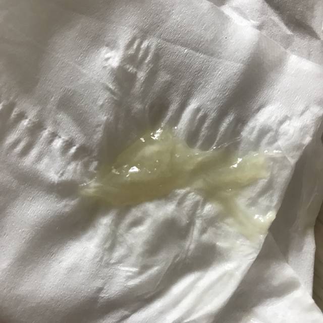 这个是宫颈粘液吧?有图慎入