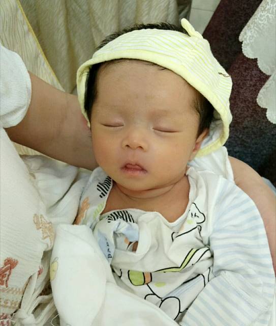 【新手报到】脂溢性湿疹 有图慎入!