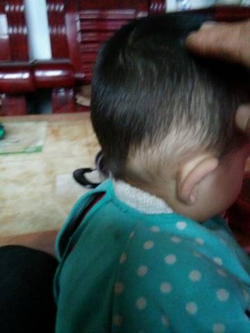 我家宝宝一岁四个月了掉头发怎么回事啊,就着