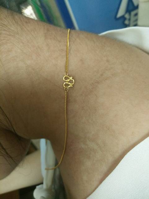 有没有孕妈像我这样,脖子黑黑的一层?