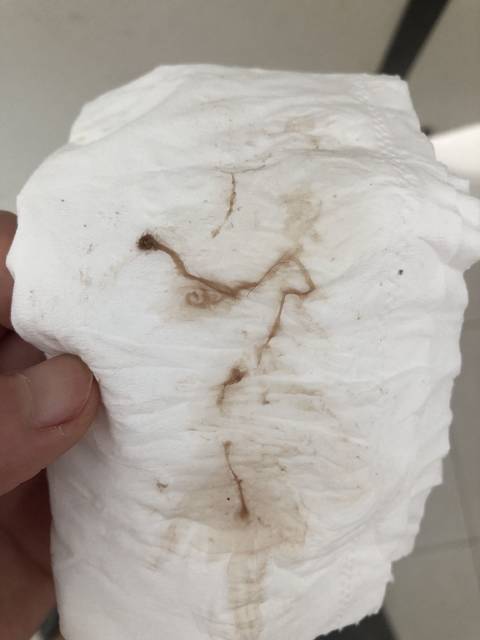 刚测出怀孕就出血,肚子痛,正常么?(有图,高能预