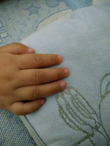 我宝宝十个月了,今天看手指甲有白色的条纹,之
