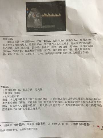 杜长庚说足先露是正常胎位?