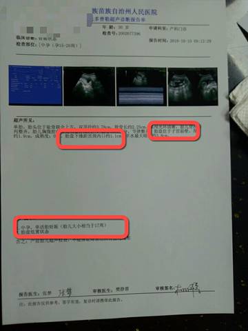 育儿问答 怀孕期 前置胎盘长上去了?