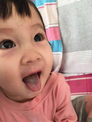 宝宝1岁4个月不爱吃饭不喝奶粉,光喝母乳,舌苔
