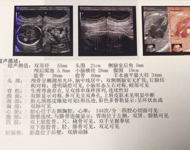 宝宝特配合,妈妈爱你哦。感觉孩子长得像我。哈哈。有没有会看的大神,帮我看看男女。 说说我的经历吧。 我结婚快五年了,一直都没要上孩子,不孕不育的项目什么的都查过,医生都说没问题,我老公也检查过也都好好的,我大姨妈不准,所以看了许多中医吃了很多中药,但是结果都不尽人意。这几年我看到孕妇会羡慕的流泪,听到朋友的孩子奶声奶气的叫妈妈我也会哭,我大姨妈不准,有时推迟了10天的时候我会开心的幻想自己是不是怀孕了,当看到验孕棒只有一道杠时,我只能落寞的坐在马桶上发呆。好在我的公公婆婆很好,他们从来不催我,总说缘