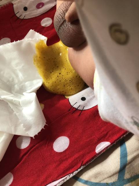 宝宝大便拉泡沫