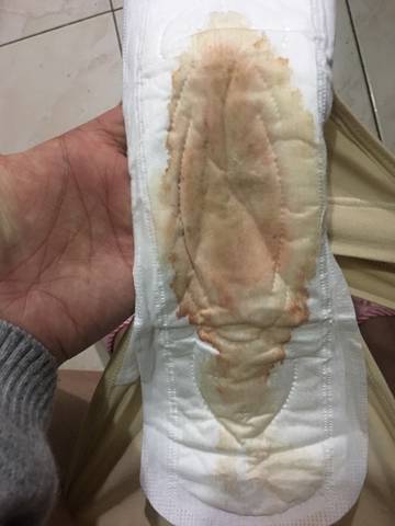 是羊水破还是分泌物?