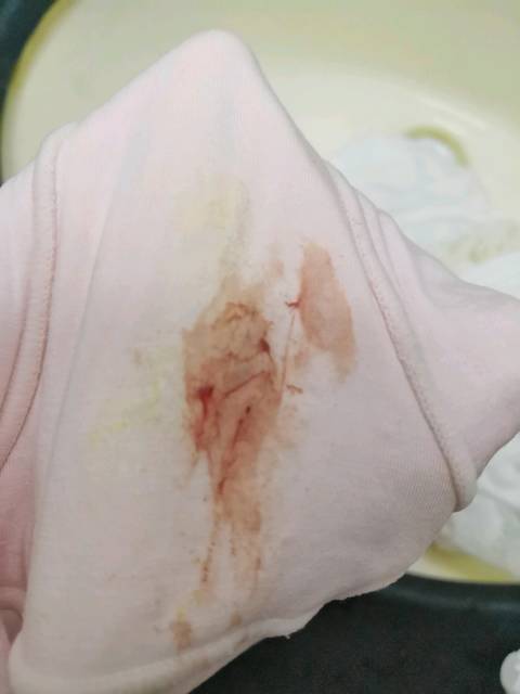 孕十一周,昨晚坐床上久了肚子疼,然后有点出血