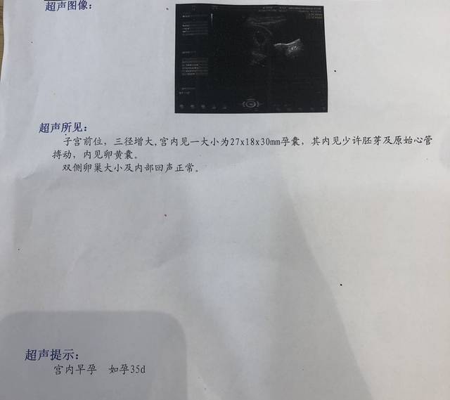 孕六周4天b超,这是已经有胎心胎芽了吗