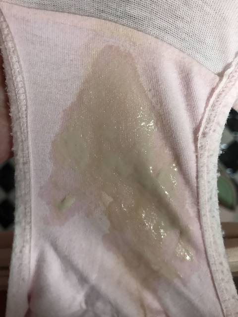 姐妹们,孕晚期了你们内裤出出现这样的吗