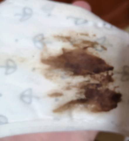 怀孕5周多,肚子有点不舒服,有褐色分泌物流出