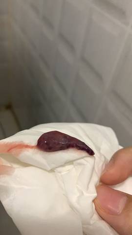 8周 4见红一礼拜去检查几次胎心都正常 有两个晚上肚子都有点闷痛闷痛
