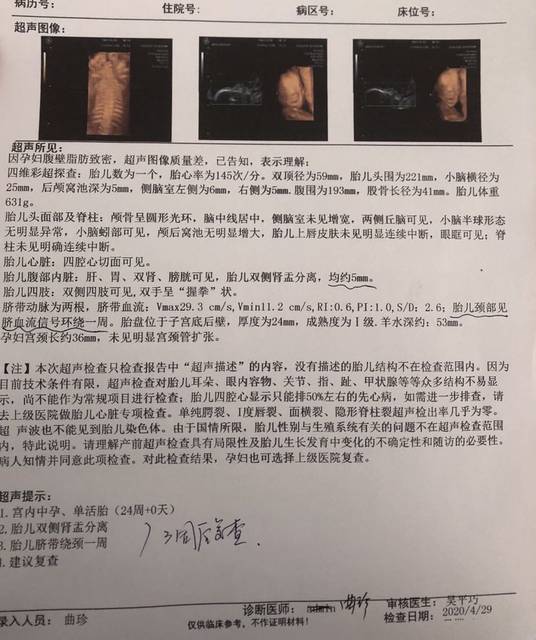 四维彩超顺利通过,男宝还是女宝?
