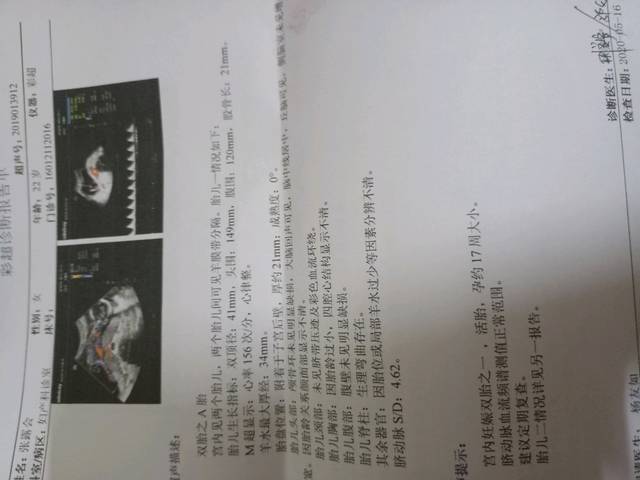 心率看男女