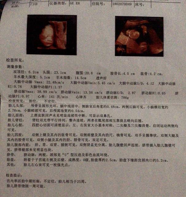 分享我怀男宝和女宝的四维给孕妈们参考一下