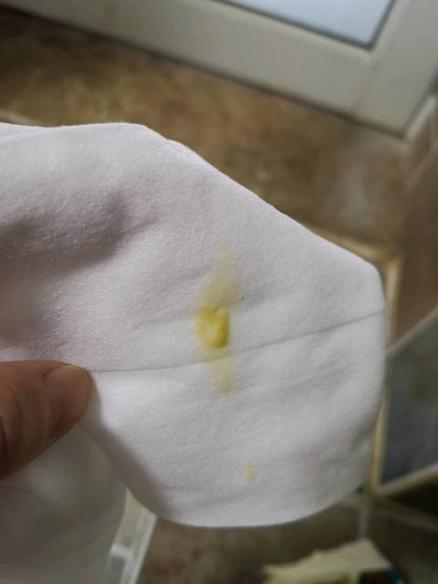 白带颜色黄黄的