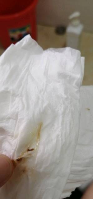 排卵期第六天,今天早上出现分泌物,怎么回事?