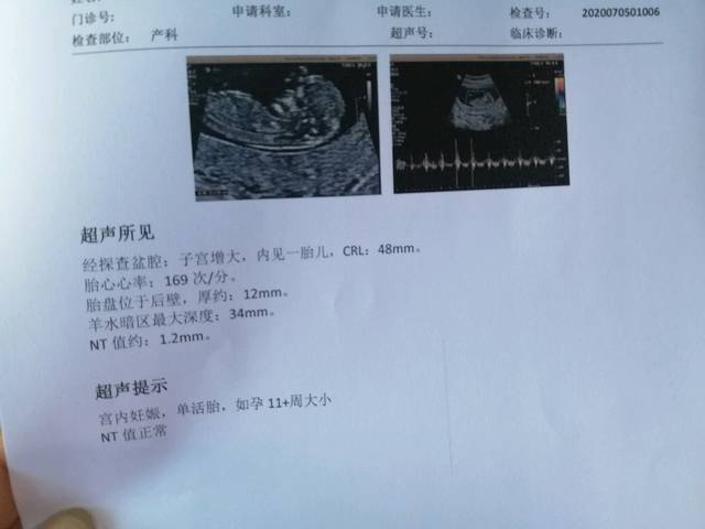 谁会看nt值分男女的?