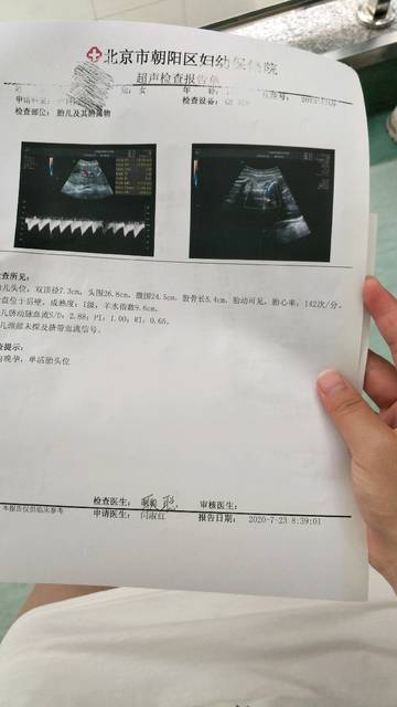 b超单看男女_大家帮我看看孕29周的b超单是男孩还是啊