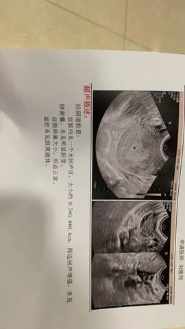 做供卵试管婴儿手术哪里好