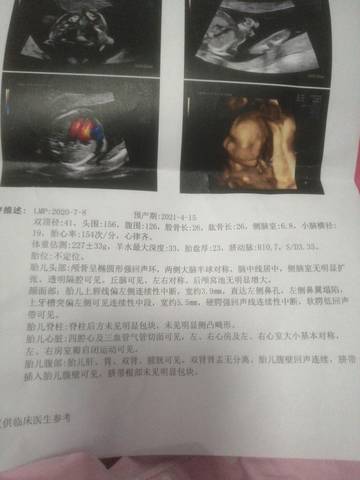 今天四维彩超出现唇裂!这严重吗宝宝还