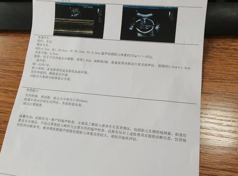 journal_insert_pic_1548915036