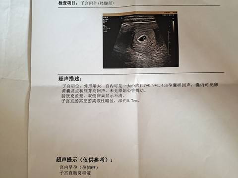 journal_insert_pic_1601299520