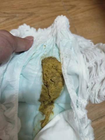 属于拉稀便嘛?